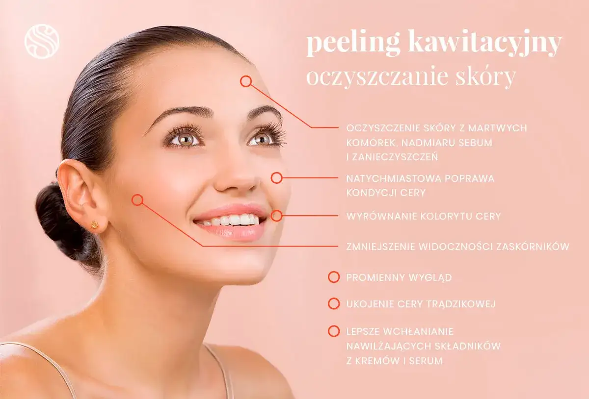 Kawitacja na twarz i ciało - efekty, cena i przeciwwskazania